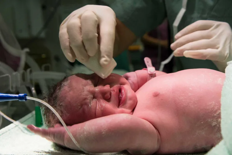 Najvi&scaron;je izplačane od&scaron;kodnine se v slovenskem zdravstvu nana&scaron;ajo na zaplete pri porodu - ko otrok preživi, a ima hude posledice. Foto: Freepik