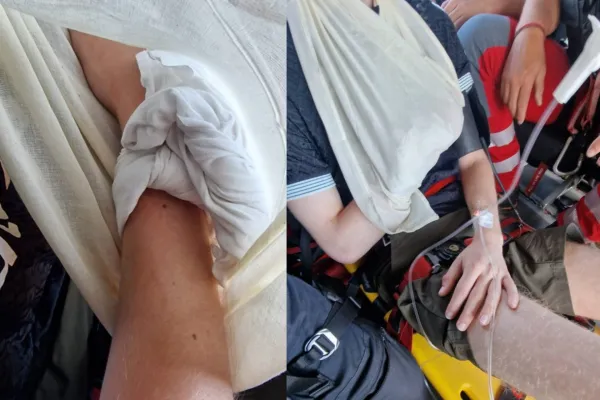 Po&scaron;kodovana sta po ugrizu pot nadaljevala do Blejske koče. Foto: PU Kranj