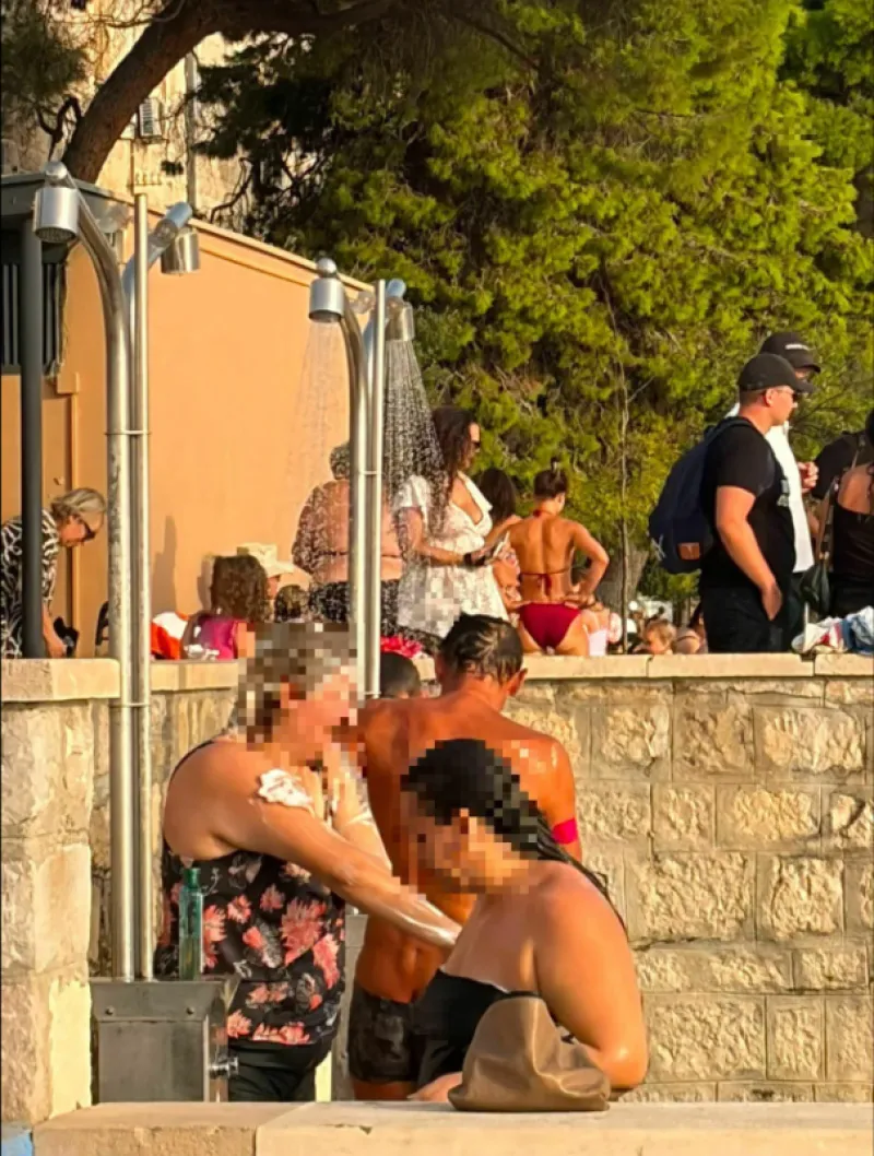 Uporaba &scaron;ampona na plaži v Zadru trn v peti kopalcem. Foto: Facebook. 